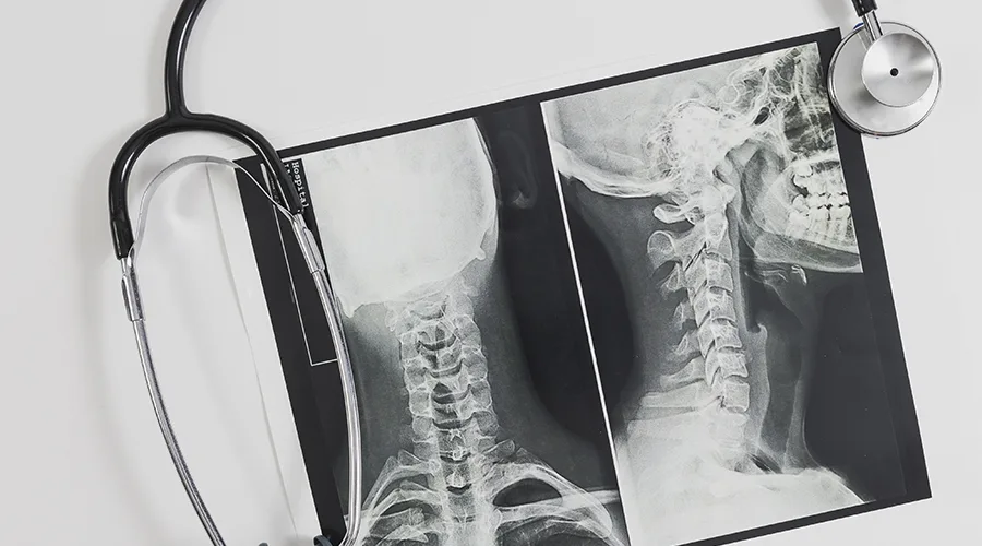 X-Ray