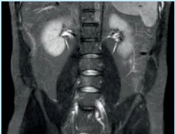 磁力共振 (MRI)