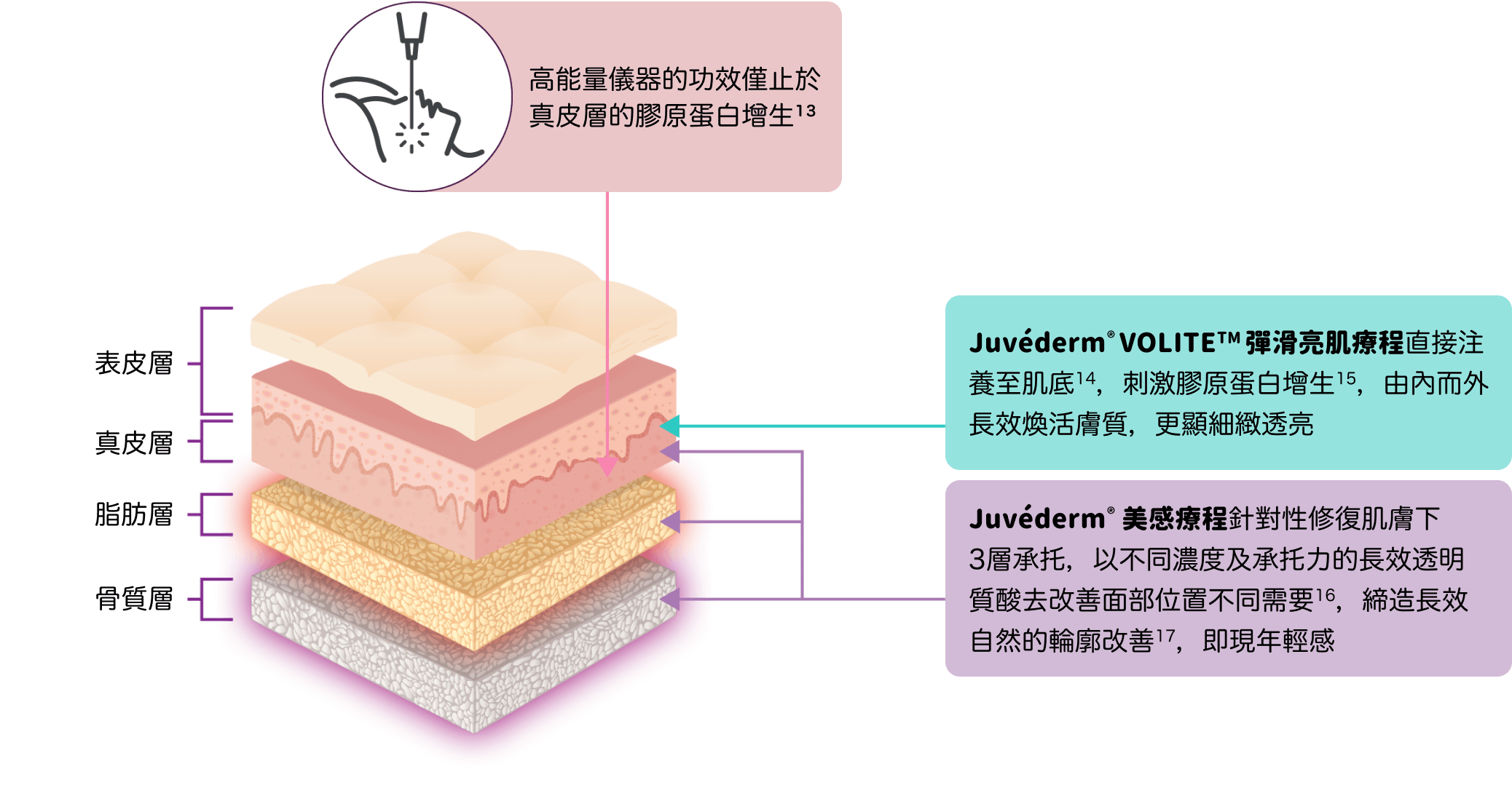 【Christmas Special Offer】 Juvéderm® Long-Lasting Hyaluronic Acid Contour Enhancement Treatments (Volite / Voluma / Volift)