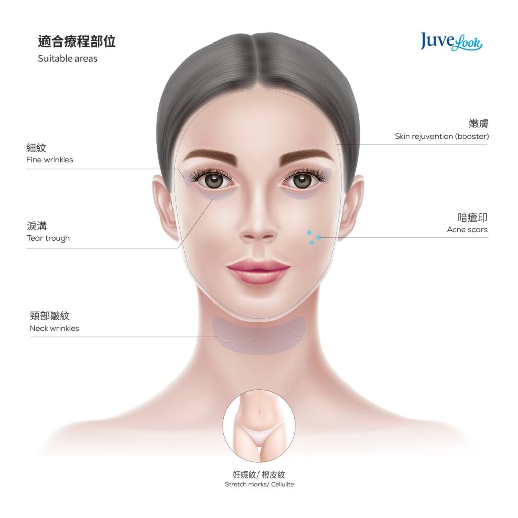 【Limited Offer】Juvelook Collagen Skinbooster