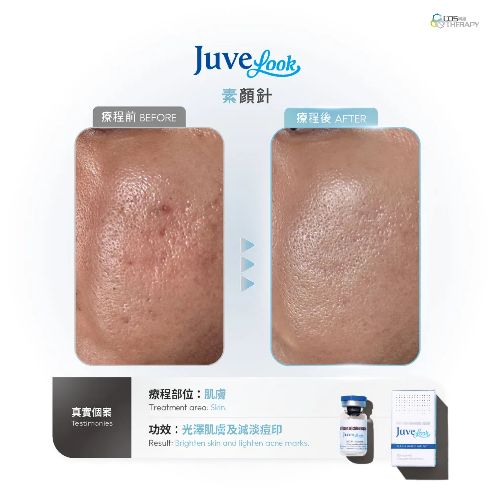 【Limited Offer】Juvelook Collagen Skinbooster