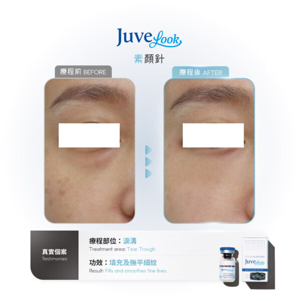 【Limited Offer】Juvelook Collagen Skinbooster