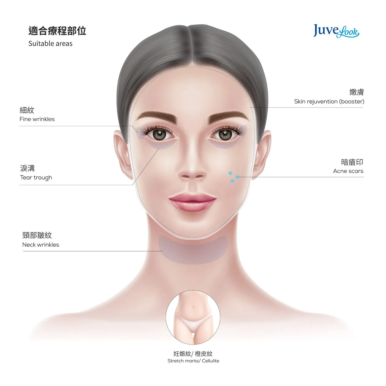 【Limited Offer】Juvelook Collagen Skinbooster