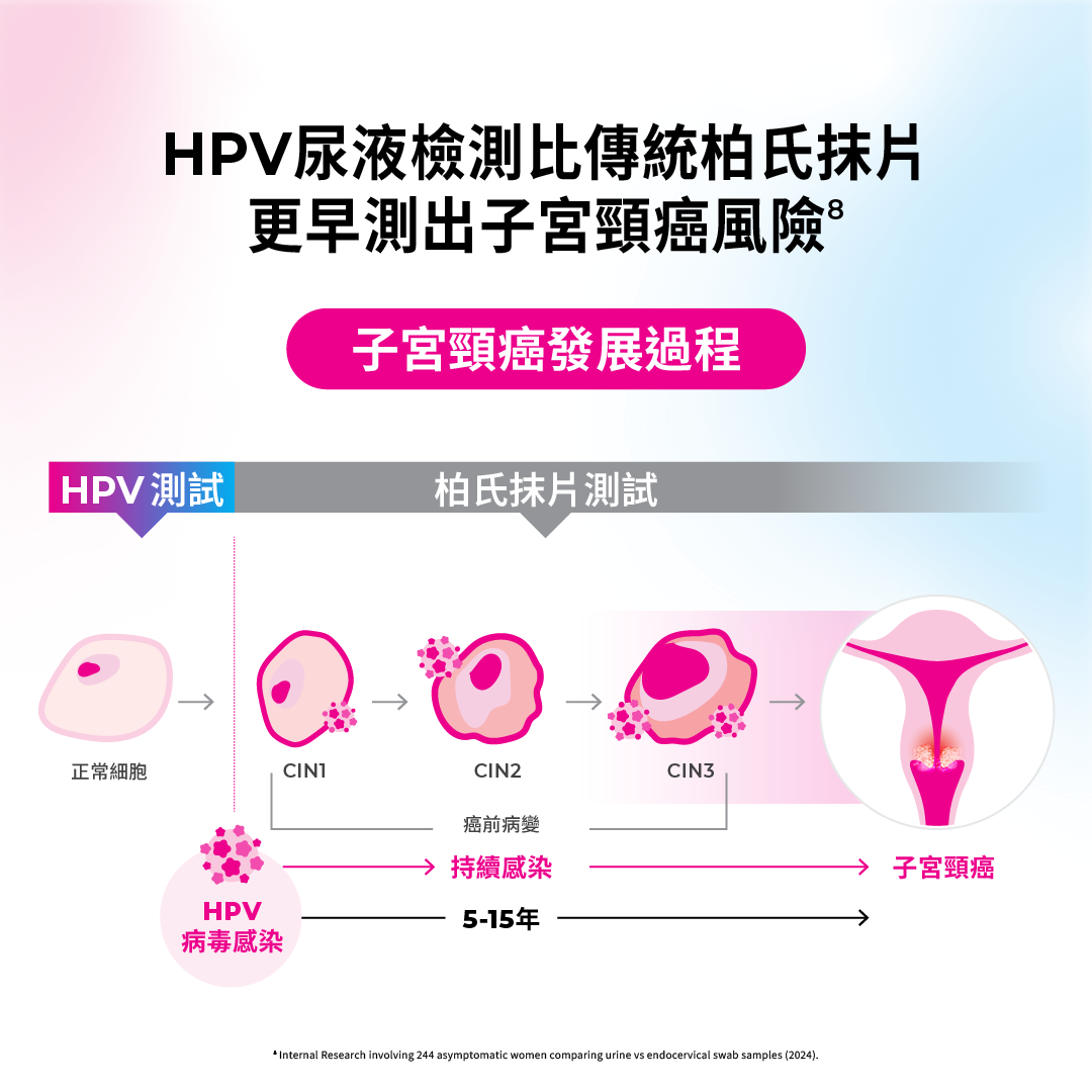 Indicaid HPV urine test