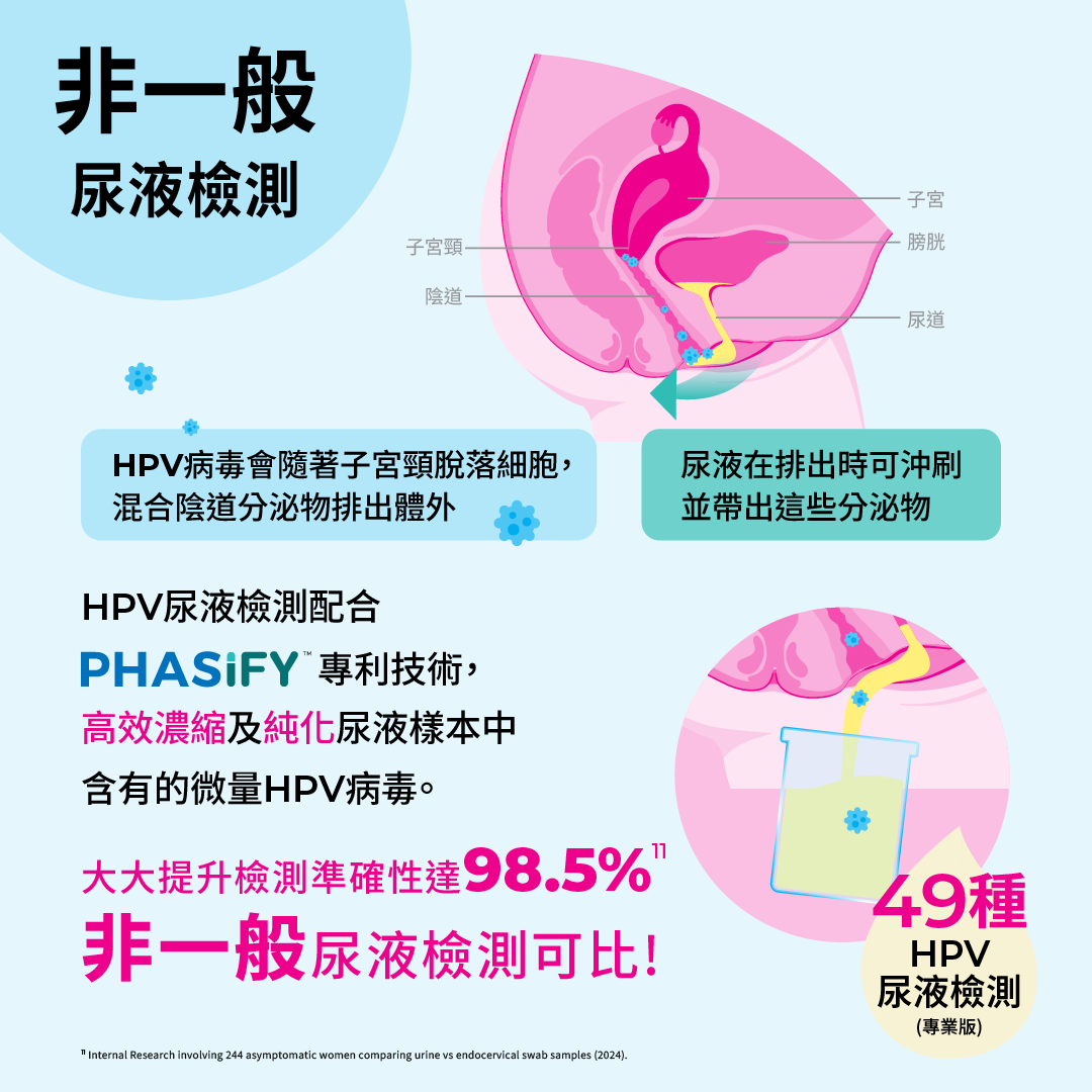 Indicaid HPV urine test