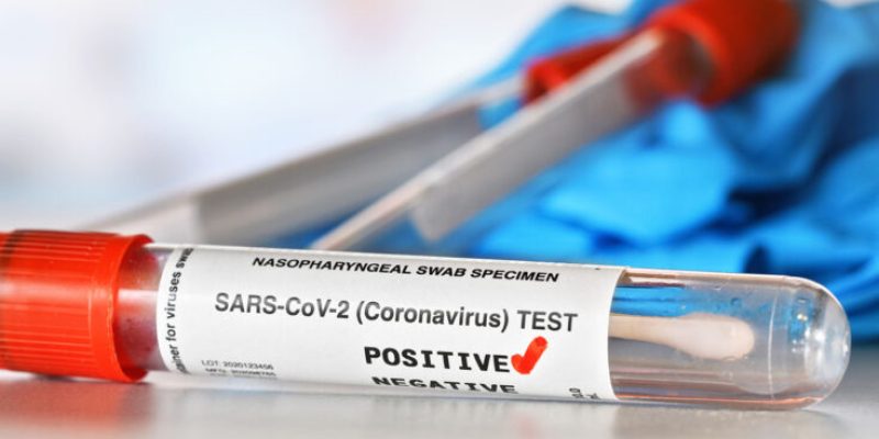 Coronavirus test concept - vial sample tube with cotton swab, red checkmark next to word positive, blurred vials and blue nitrile gloves background. (Sticker is own design with dummy data)