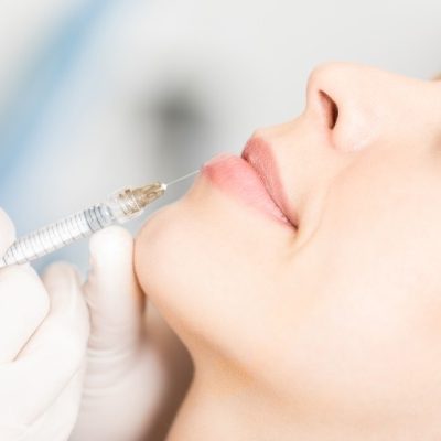 dermal-fillers