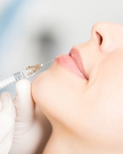 dermal-fillers